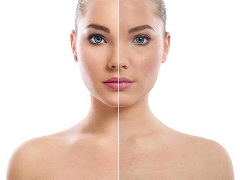 CANDY BELLA: Polvo fijador. ¡Adiós brillo, hola perfección!